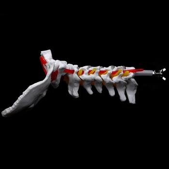 Hot 1 Pcs Anatomia Humana Esqueleto Coluna Vertebral Disco Lombar Modelo De Ensino E 1 Pcs Vértebra Cervical Arteria Coluna Vertebral, Nervos Modelo